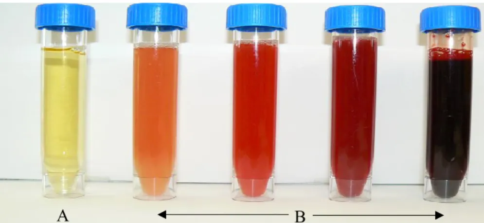 Figure 2. Urine microhématurique (A) et urines macrohématuriques (B) 