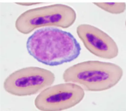 Figure 4 : Photographie microscopique 1000X (objectif 100X) d’un frottis sanguin  (coloration  Dip Quick) illustrant la présence d’un rubriblaste ou d’un prorubricyte  chez une crécerelle d’Amérique 