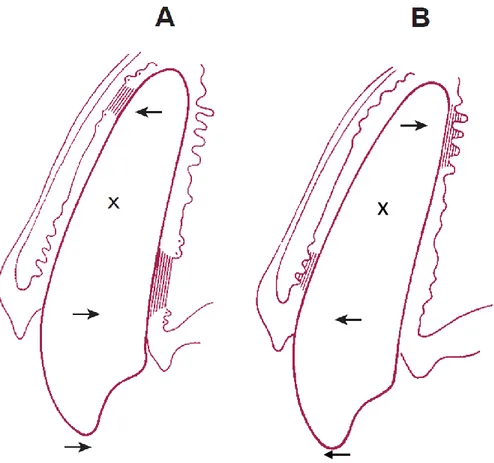 Figure I.  Schéma des zones de compressions maximales dans le LPD suite à  l’application d’une force de bascule; a