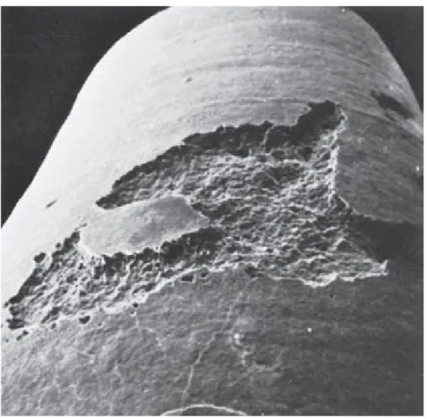 Figure IV.  Image par microscope à balayage électronique d’une lacune de  résorption radiculaire(6) 