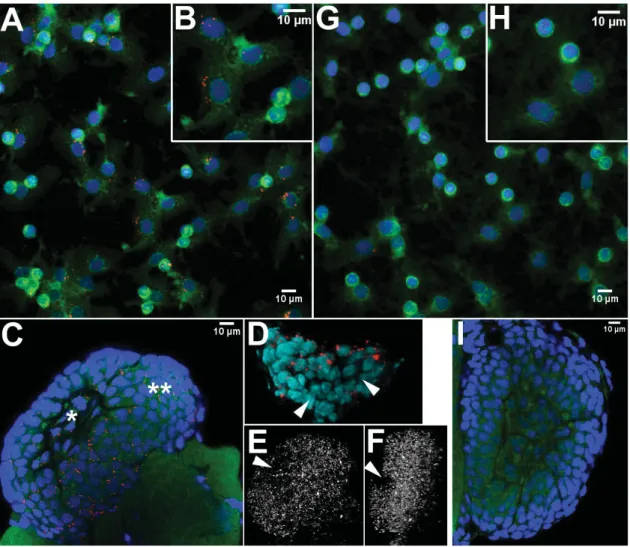 Figure III-2 – Détection de Wolbachia par FISH dans les hémocytes circulants et les organes hématopoïétiques