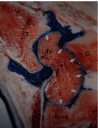 Figure 2 – Section sagittale à travers l’aspect latéral du tarse d’un bovin. L’articulation  crurotarsienne communique avec l’articulation intertarsienne proximale entre l’aspect latéral du  tibia et la lèvre latérale de la trochlée du talus (flèches)