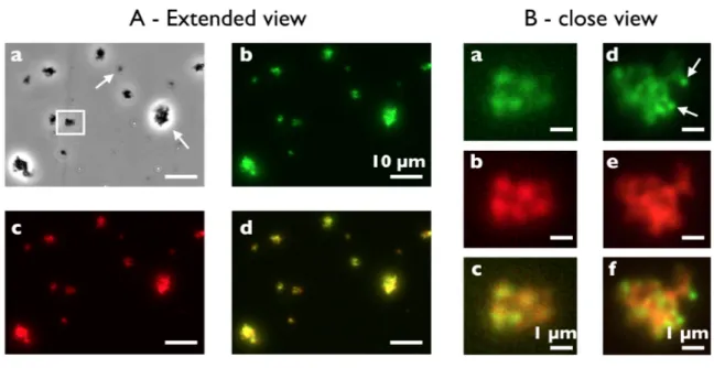 Figure  5:  Extended  (A)  and  close  (B)  illustration  of  aggregates  made  from  42  nm  aminated  silica  nanoparticles  and  native  Curosurf®  observed  by  optical  and  fluorescence  microscopy  (magnification  60×)