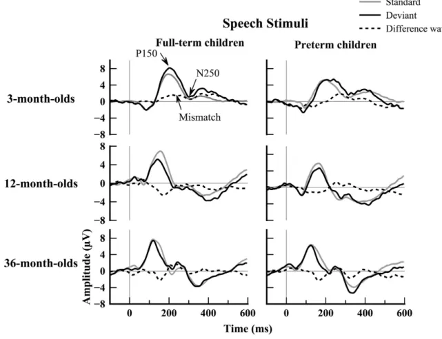 Figure 1. Grand average standard, deviant and differential waveforms to speech stimuli 