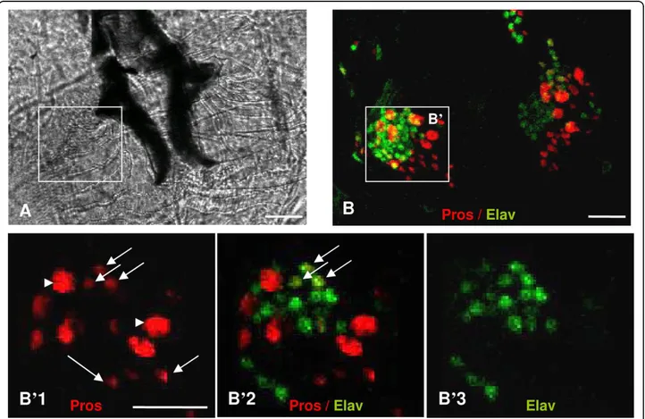 Figure 1 AMC region from third instar larvae observed by optical microscopy. (A) Bright-field view of the larval AMC region (dorsal view, anterior down), the hooks appear in dark