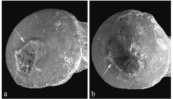 Tableau 4 Longueur et largeur des fovéas droite et gauche / Length and width of the right and left fovea capitis