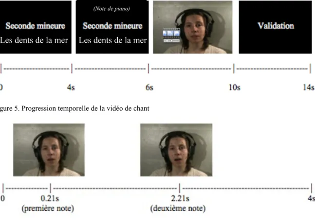 Figure 4. Déroulement de la tâche de perception du chant 