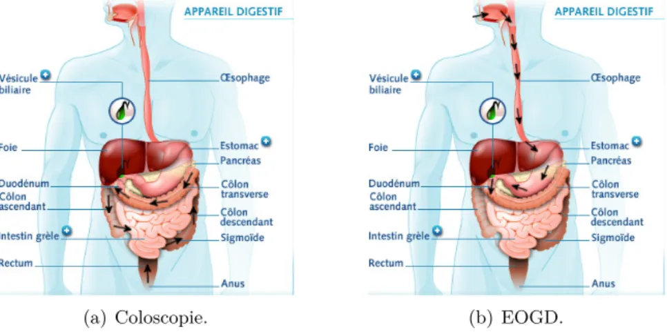 Figure 1.7 – Examens endoscopiques intestinaux.