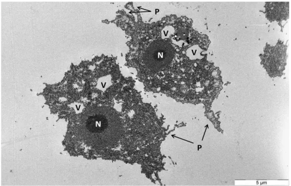 Figure 5 : Coupe transversale d’un trophozoïte d’ A. castellanii  ATCC 30010 observée au  microscope  électronique  à  transmission