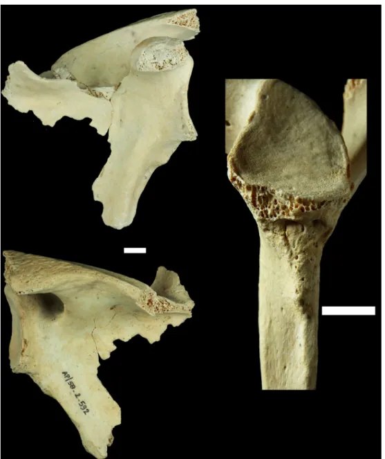 Fig. 6 Scapula gauche (AP/58-2-592) (échelles : 1 cm). Vues antérieure, postérieure et vue rapprochée du bord latéral et de la cavité glé- glé-noïde (clichés S
