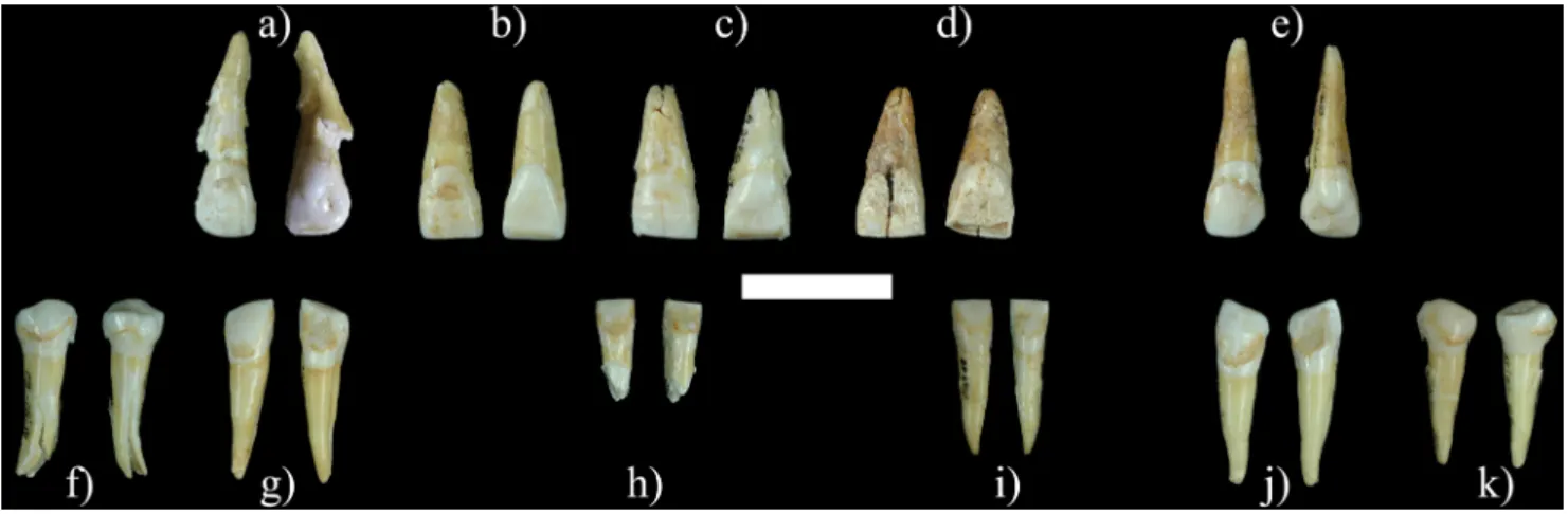 Fig. 2 Dents permanentes attribuées à P1 (échelle : 2 cm), faces vestibulaire et linguale