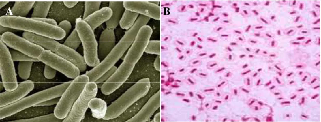 Figure 14 :  Klebsiella pneumoniae en (A) microscopie électronique à balayage  (klebsiella- (klebsiella-pneumoniae.org consulté le 30/08/216) (B) coloration de Gram 