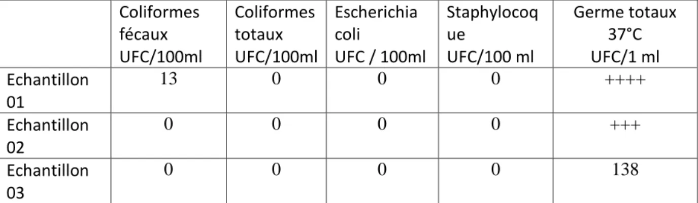 Tableau  06:  La  qualité  microbiologique  des  eaux de  la  piscine  de  Guemar.  ++++:  Grand  nombre non quantifiable de colonies