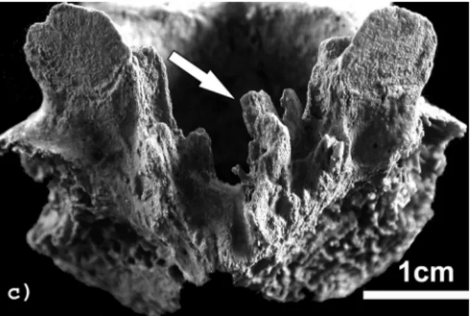 Fig. 4c - Enthèses du groupe 3, insertions distales.