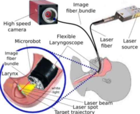 Figure 1: Current laryngeal laser surgery setup.