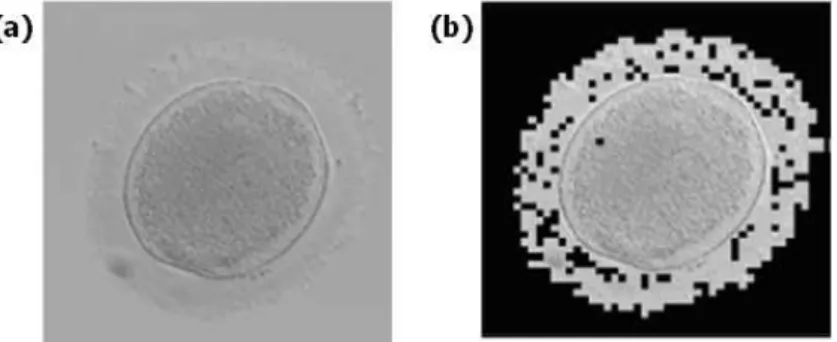 Figure 4. Image processing used to estimate the absorption of the  oocytes. (a) The initial image