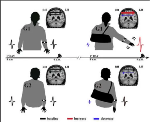 Figure 5 : Illustration de la procédure expérimentale et des effets obtenus sur la balance  inter-hémisphérique des cortex moteurs primaires en fonction du groupe