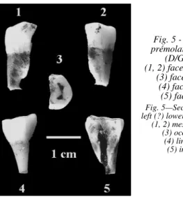 Fig. 6 - M2 inférieure gauche n° 884,  (1) face occlusale, 