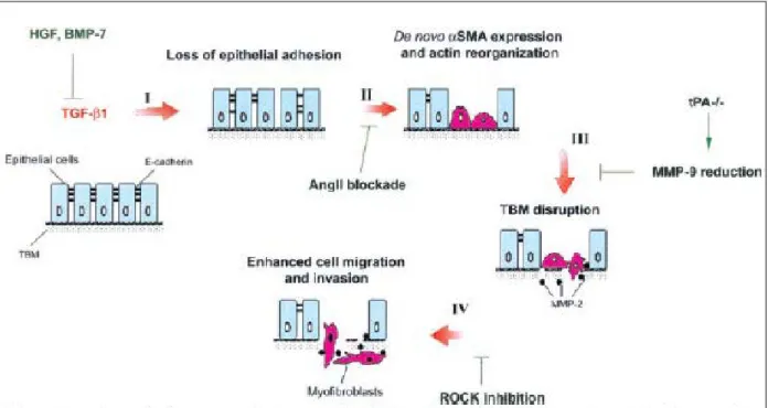 Figure 10 : Représentation des événements possibles intervenant dans la TEM (104) 