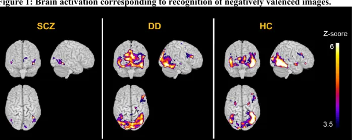 Figure 1: Brain activation corresponding to recognition of negatively valenced images
