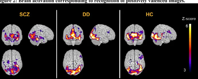 Figure 2: Brain activation corresponding to recognition of positively valenced images