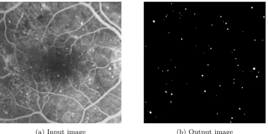 Fig. 1: Example of an image processing application: automatic detection of retina damage