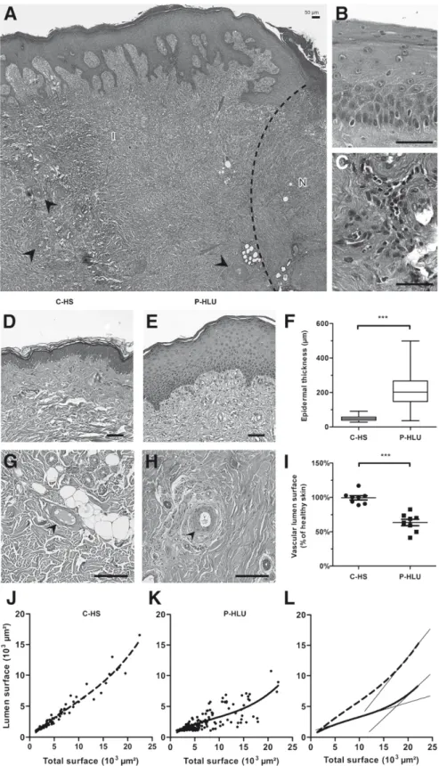 Figure 1 Histological analysis of HLU lesions.