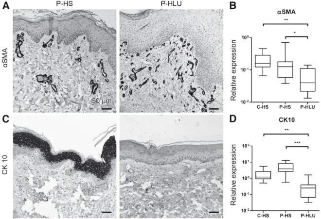 Figure 3 Expression of a-SMA and cytokeratin 10 (CK10) in HLU. IHC of patient healthy skin (P-HS) and patient HLU (P-HLU) biopsies stained for a-SMA (A and B) or CK10 (C and D) antibodies, images are representative of four different patients