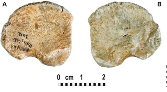 Figure 6 - Arcy 63 R Xb2 C12 3012, Ilium  droit d’un fœtus ou d’un périnatal. A : face  externe et B : face interne