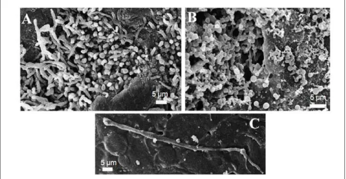 Figure 6 : Observations en MEB d’un biofilm de Candida spp. retrouvé sur la prothèse  dentaire d’un patient atteint de stomatite ( A-C) (Ramage et al., 2004)