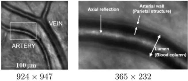 Figure 1: A mean image produced by [5] acquired the rtx1 camera [6] (left) and a detailed view of an artery (right)