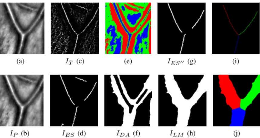 Figure 2: Steps for axial reflection detection: The source image (a) is first pre-processed (b)