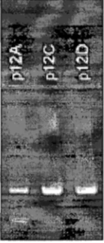 Figure 3.2)  Electrophoresis  gel  showing  amplicon  of approx.  450  bp  (upper  bands),  as  weIl  as  smaIl  fragments  (Iower bands)  caused  by  primer dimer, for three sister spores