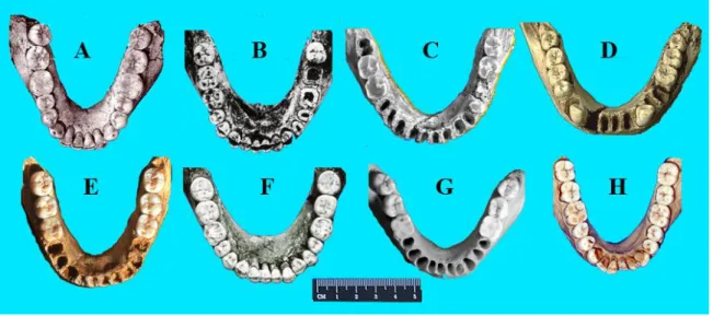 FIGURE 7. — 1,8ma d’évolution des arcades alvéolo-dentaire. Elles ont toutes 32 dents sans diastèmes avec une canine au même niveau  que les autres dents