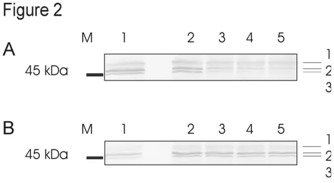 Figure 2  Analyse par immunodétection de la stabilité de l’HK suite à l’utilisation du  tampon d’extraction amélioré ou du tampon d’extraction de Renz et al