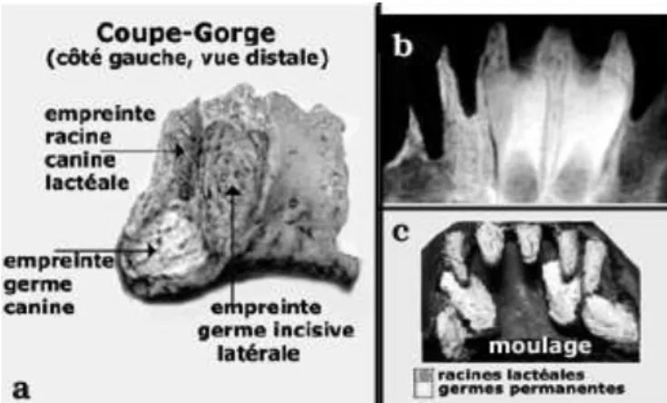 FIGURE  1.  — Le  Coupe-Gorge.  a  .Portion  symphysaire  vue  du  côté  gauche  avec  les  empreintes  laissées  par  les  germes  des  dents permanentes, b