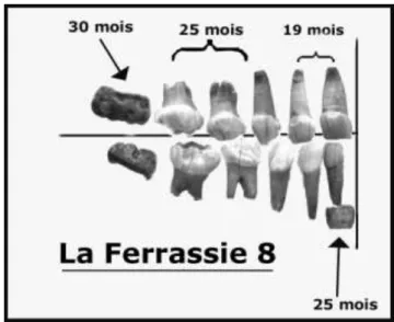 FIGURE  2.  — Radiographie  de  la  canine  en  place  .  Maxillaire  fossile du Coupe-Gorge