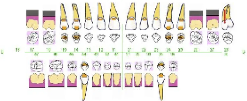 Figure 1: An example of dental scheme, exhibiting any treatment on a patient’s dentition