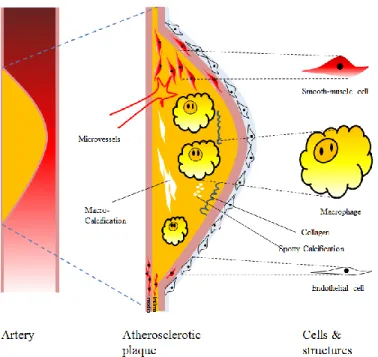 Figure 1.2: Atherosclerotic plaque composition  