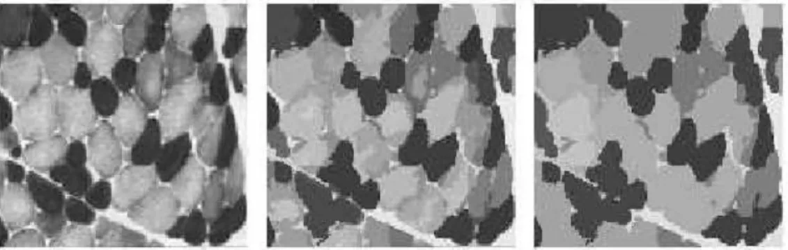 FIGURE 3.2 – Image ’muscle’ à différentes résolutions de détails [Bertolino, 1995].