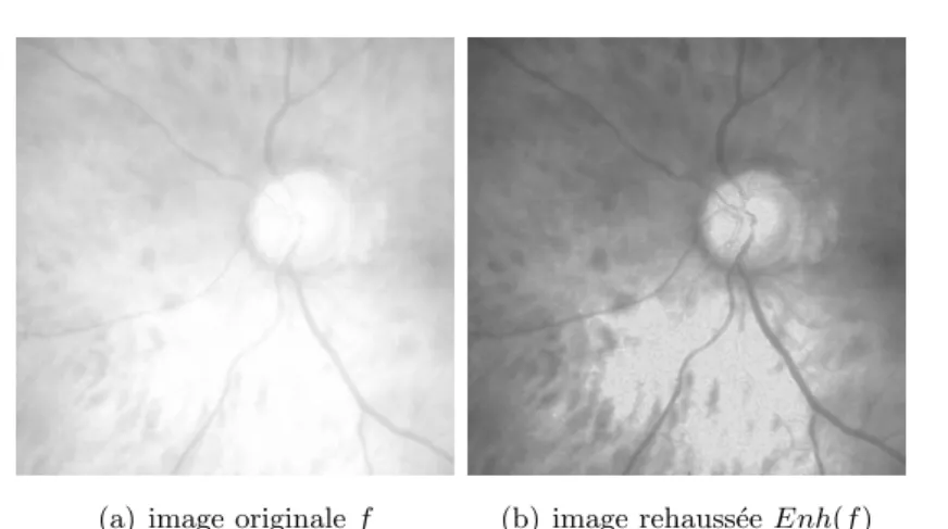 FIGURE 4.1 – Maximisation de la plage dynamique de l’image rétinienne de l’oeil humain