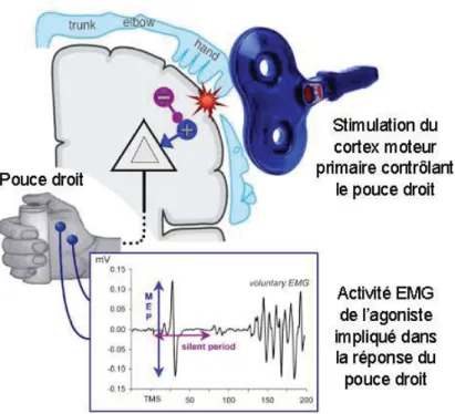 Figure 14. Illustration d’un protocole de stimulation magnétique transcrânienne (SMT)