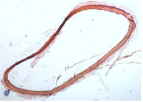 Figure  5: morphological analysis of a  rat aorta section, removed after 24 days  in the bioreactor