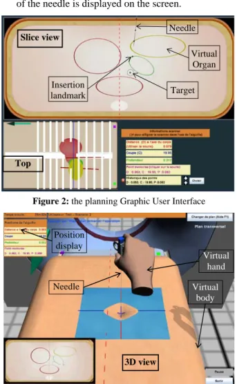 Figure 2: the planning Graphic User Interface 