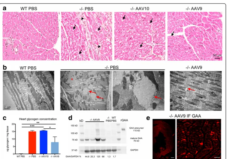 Fig. 7 Cardiac muscle pathology improvement is correlated to the presence of GAA. a Representative cross sections of the left ventricular free wall, paraffin embedding, hemalun-eosin-saffron stain