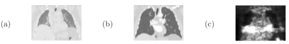 Fig. 1. CT images (a,b) corresponding to two different instants of the breathing cycle and PET image (c) of the same patient (coronal views).
