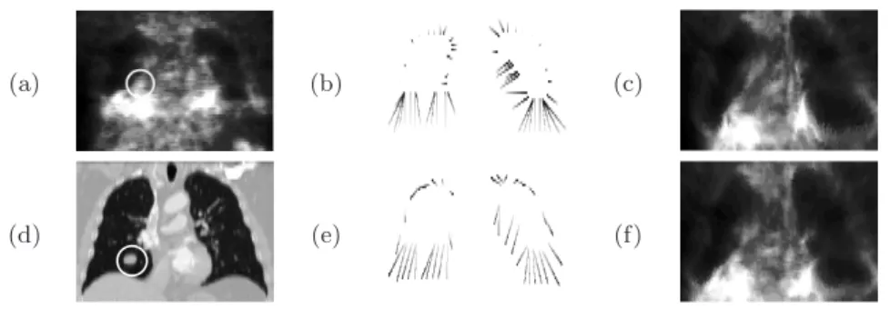 Fig. 5. Same as in Fig. 4(a–f) for a pathological case (the tumor is surrounded by a white circle).