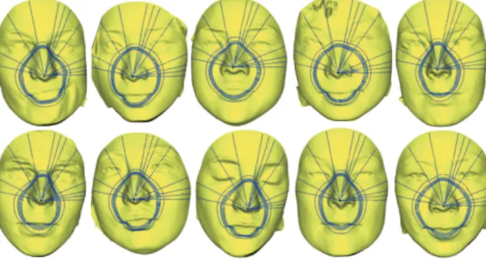 Fig. 6: Relevant radial and iso-level curves selected by Boosting given on different male faces.