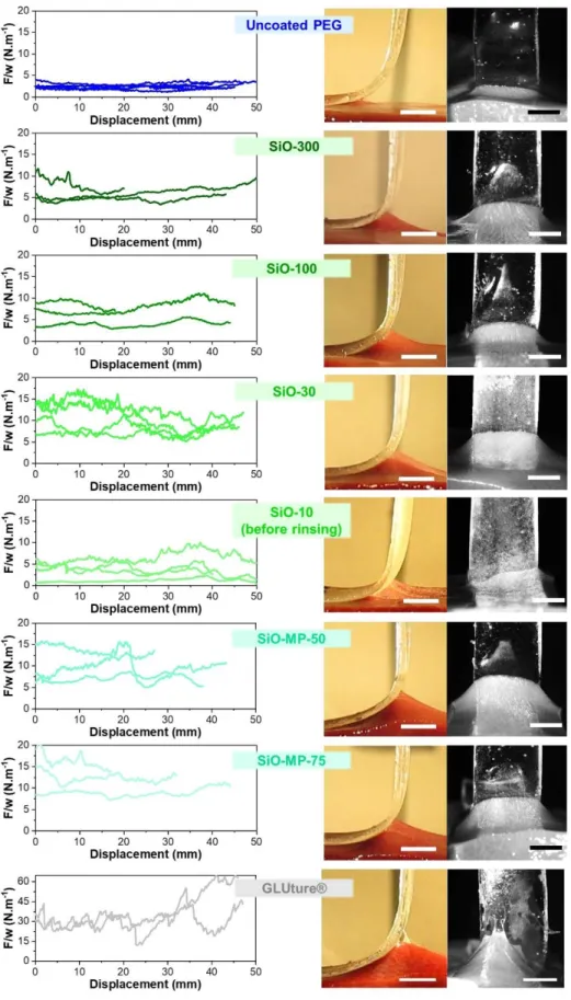 Figure S4: Ex vivo peeling force and snapshots (side and front view) of the peeling experiments obtained 