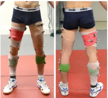 Figure 1. Subject equipped with 30 reflective markers (14 sin- sin-gle markers and 16 markers on technical clusters placed on both thighs and shanks)